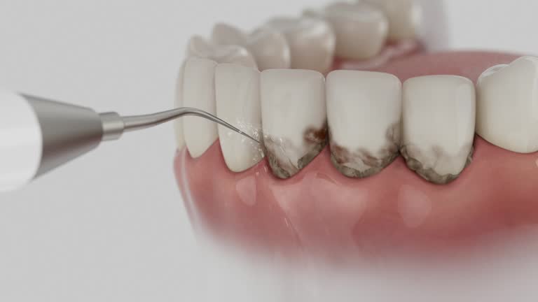 Reliable Root Canal Treatment contractor in Franklin County County, KY by Dentist Open Now